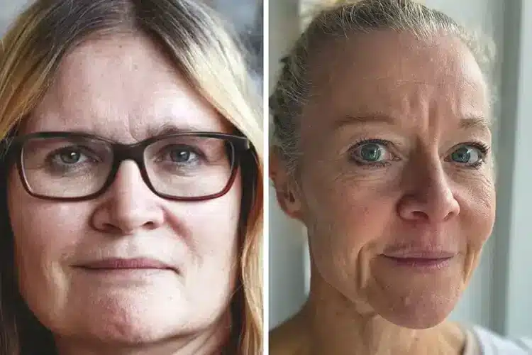 Hvorfor overses piger og kvinder med ADHD